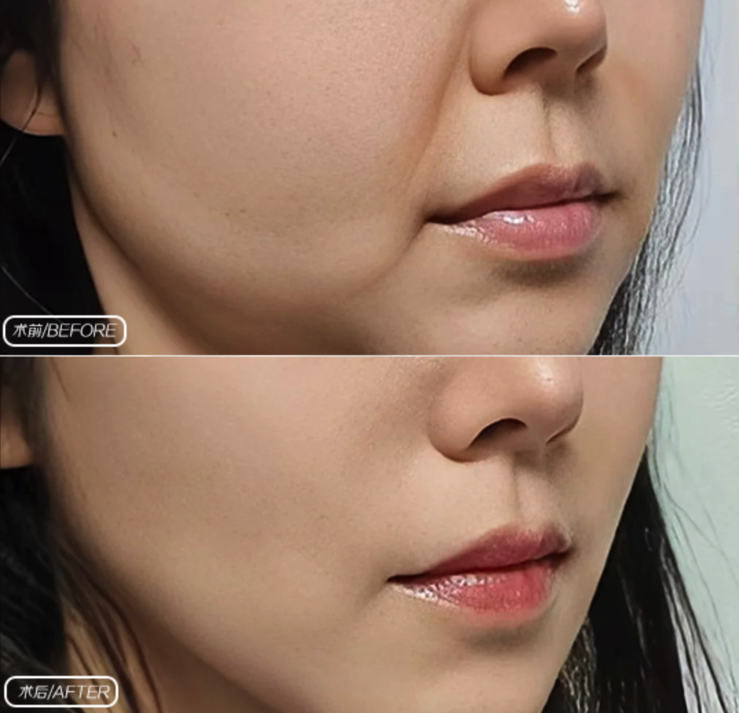 photo-11