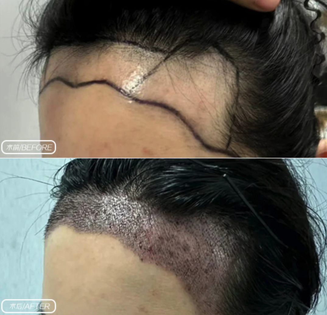 photo-18